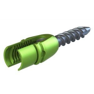 TiLock Reduction Screw