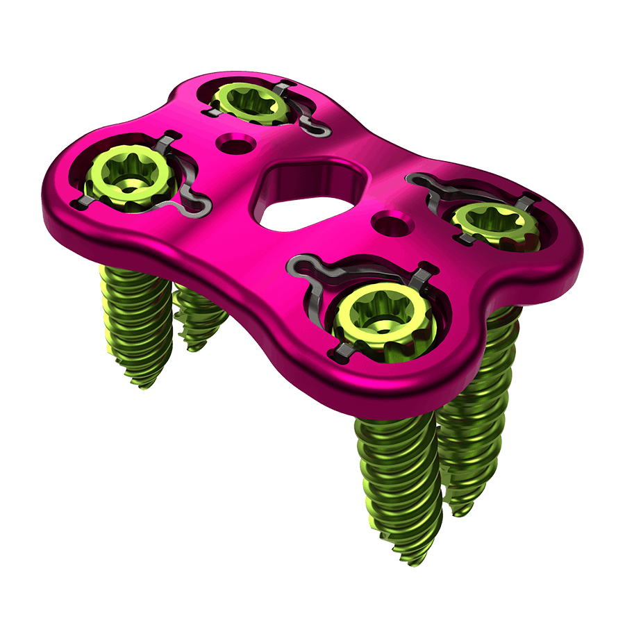 Binary Lumbar Plate System