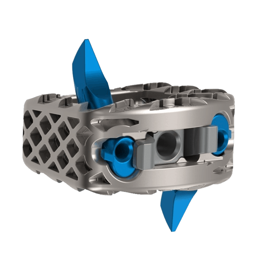AIS-C 3D Printed Cervical Standalone System with SemaFour® Technology