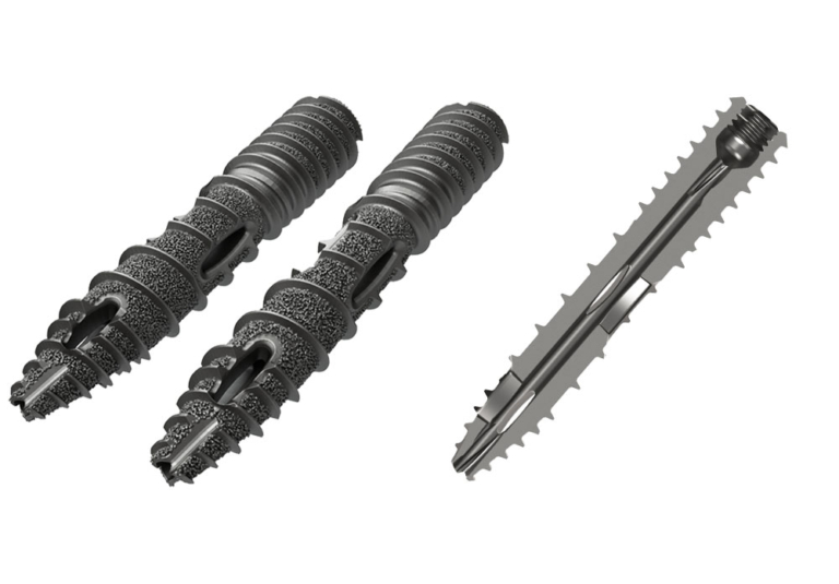 Oblique Sacroiliac Joint Fusion – SIros O 3D Printed - Genesys Spine