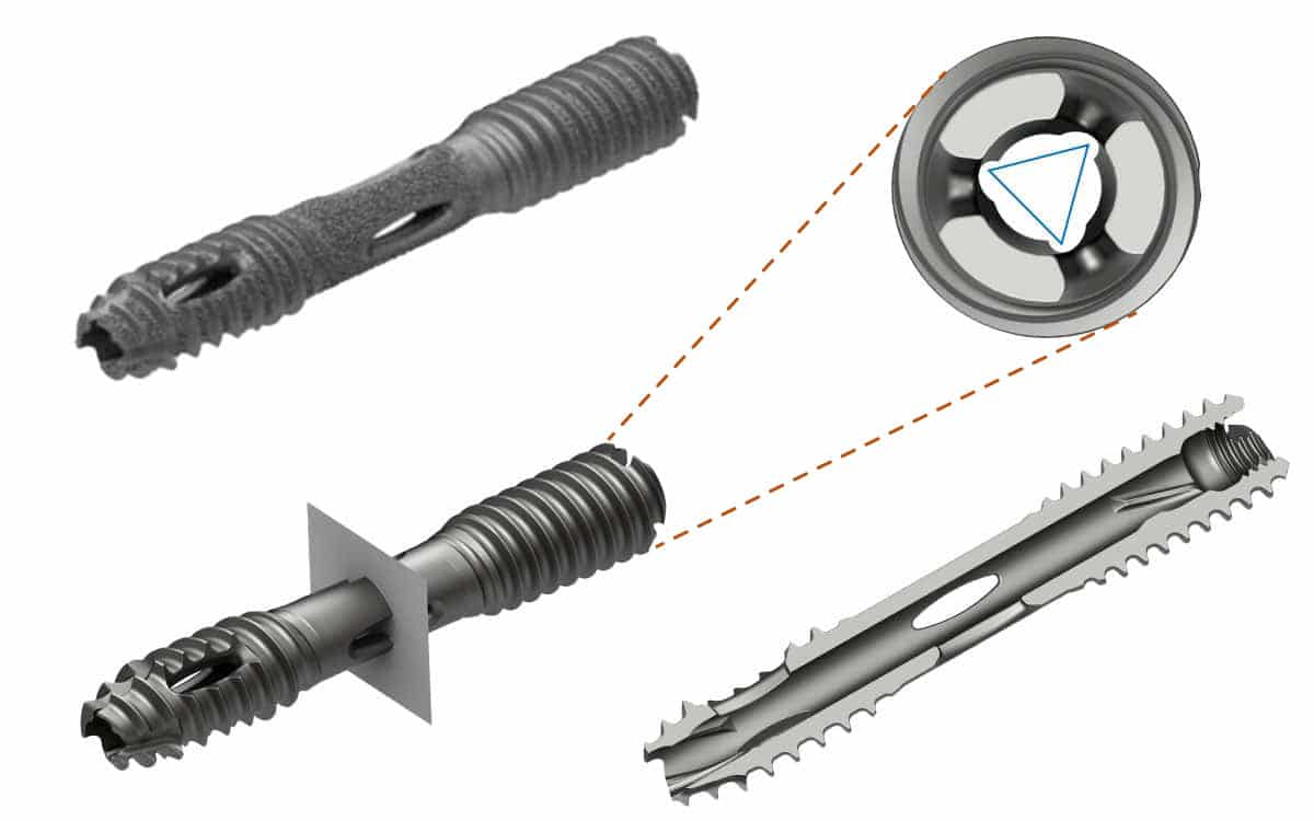 1200x750-SIros-Lateral3b